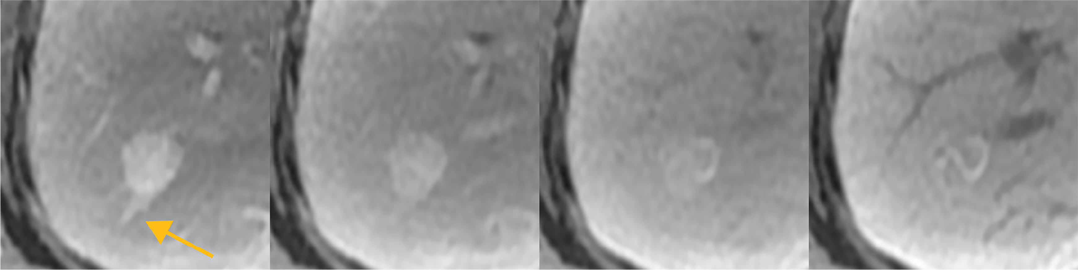 Fig. 3. Dynamic imaging
