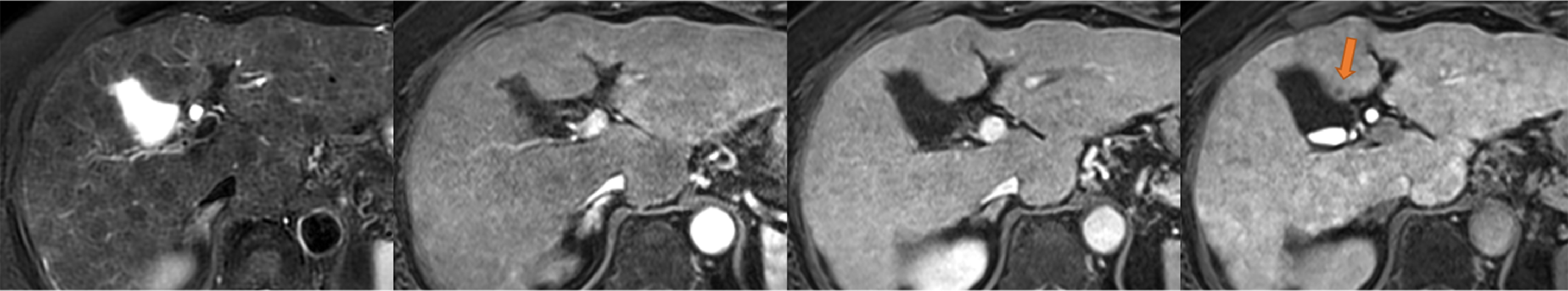 Fig. 2. T1-, T2- and diffusion-weighted imaging
