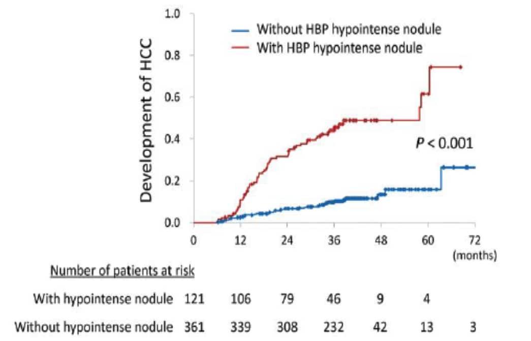 Fig. 2. Cumulative rates of HCC development based on the presence HBP hypointense nodules