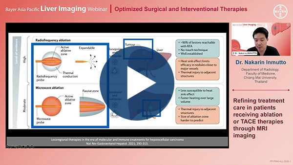 Refining treatment care in patients receiving ablation or TACE therapies through MRI imaging