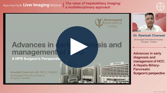 Advances in early diagnosis and management of HCC: A Hepato-BiliaryPancreatic Surgeon's perspective